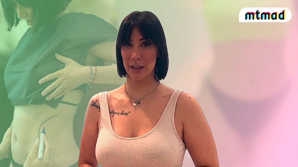 fani carbajo somete liposuccion resultado antes despues mitele