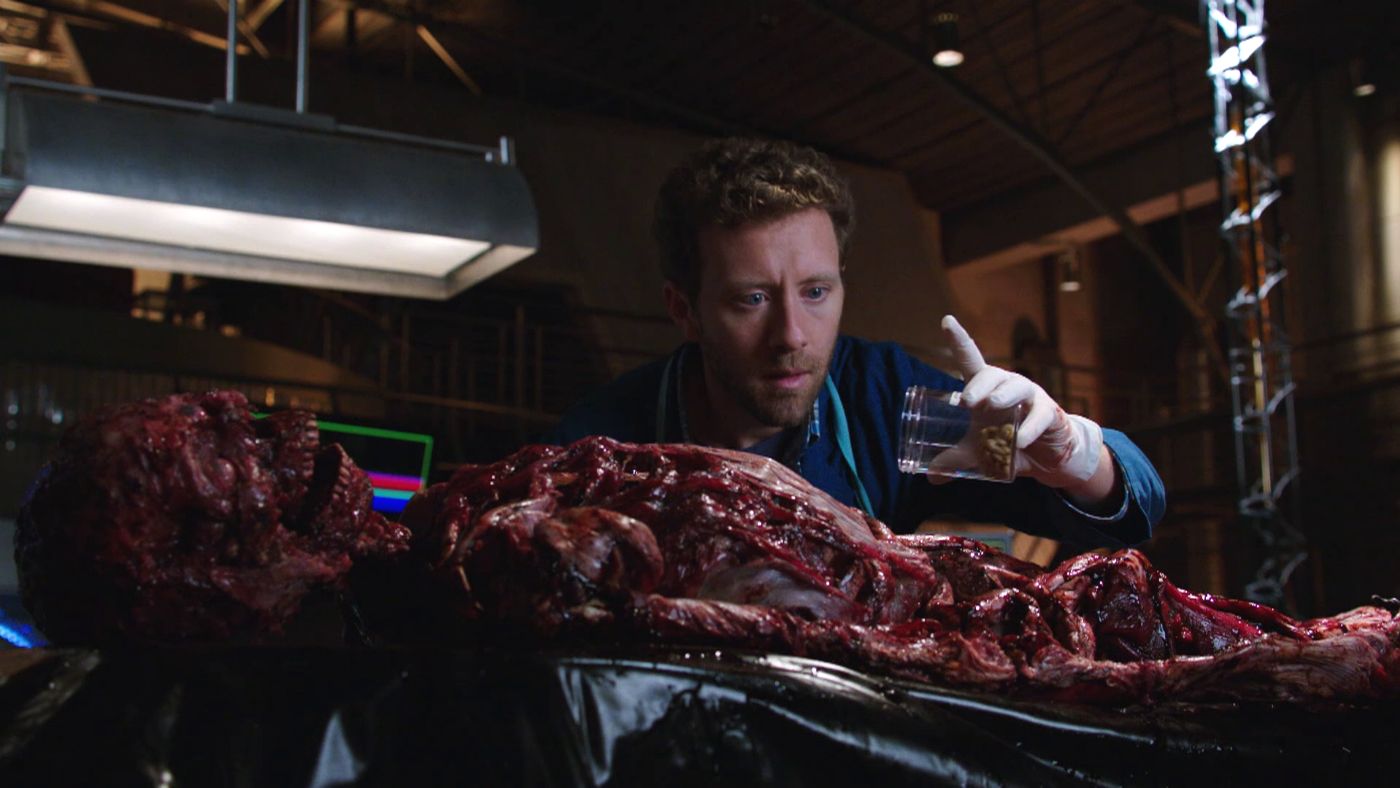 bones170