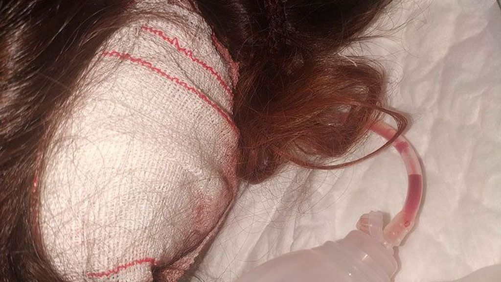 Cristina, 16 años: víctima de una agresión multitudinaria: " Buscaban a su hermana pequeña, que tiene 5.825 seguidores en Instagram" Cristina, 16 años: víctima de una agresión multitudinaria: " Buscaban a su hermana pequeña, que tiene 5.825 seguidores en Instagram"