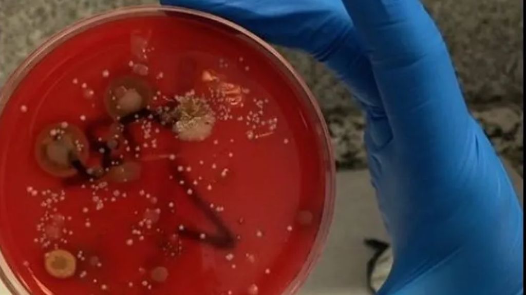 Las bacterias que se esconden tras el mal uso de la mascarilla