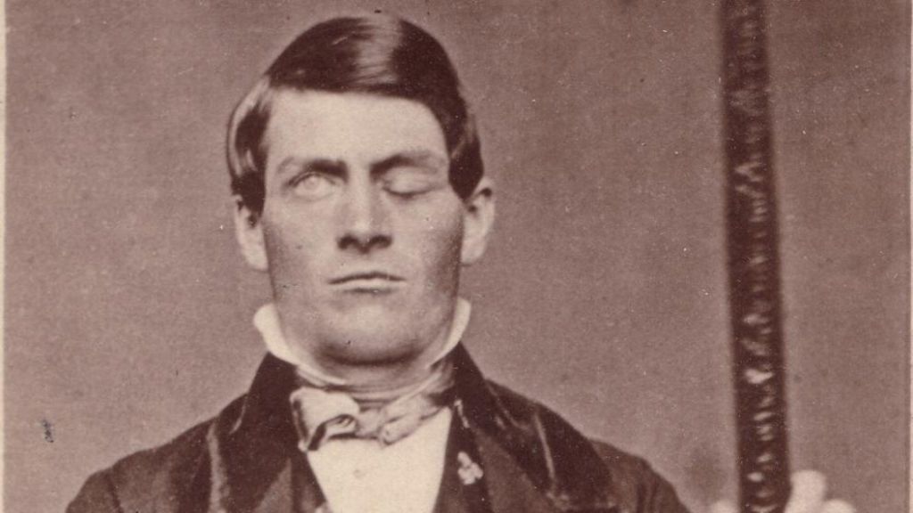 Una viga atravesó su cabeza y se convirtió en un monstruo: el famoso caso de Phineas Gage