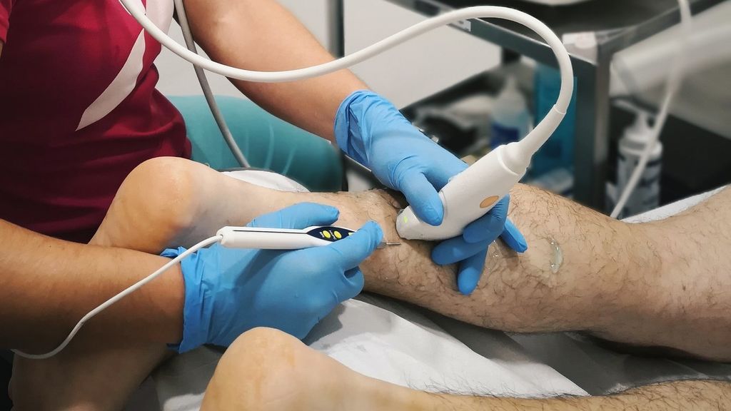 proceso de tratamiento de una rotura fibrilar