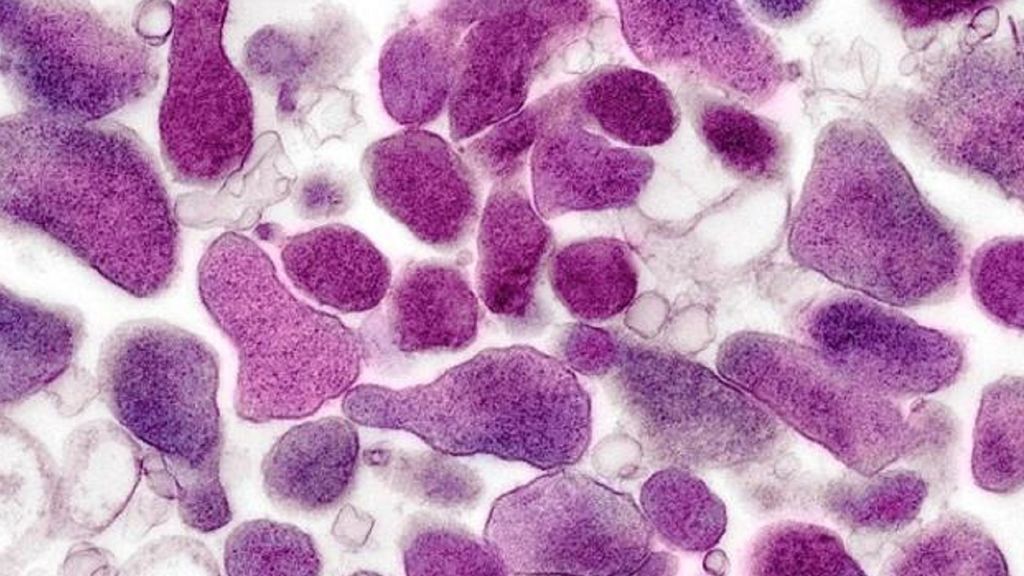 La resistencia a los antibióticos se extiende 10.000 veces más rápido de lo calculado La resistencia a los antibióticos se extiende 10.000 veces más rápido de lo calculado