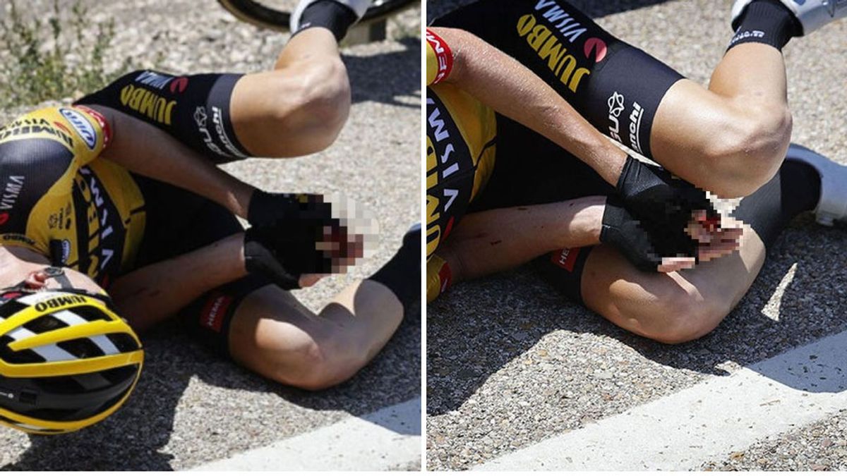 El ciclista Leemreize sufre la amputación de un dedo tras una caída en la Vuelta a Burgos