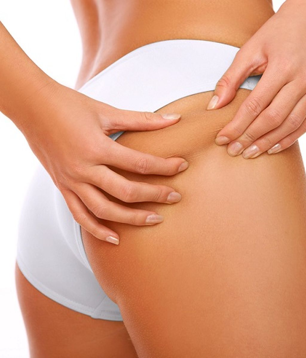 CELULITIS