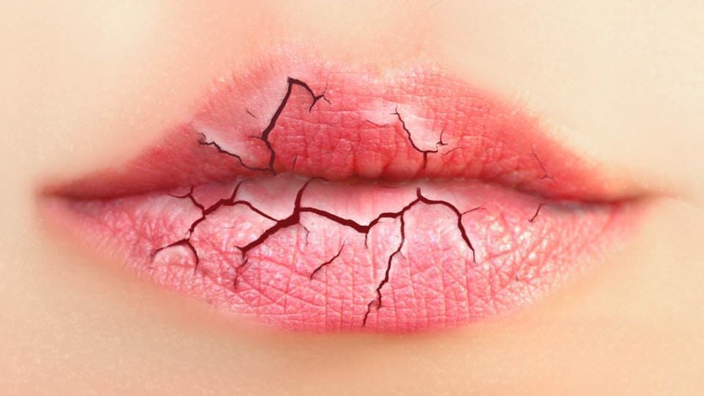 Los labios agrietados y poco hidratados serán muy comunes con temperaturas extremas.