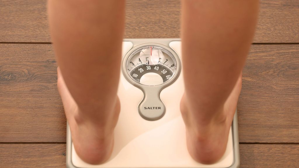 La obesidad no es sólo cuestión de peso, mucho más que dieta y ejercicio La obesidad no es sólo cuestión de peso, mucho más que dieta y ejercicio