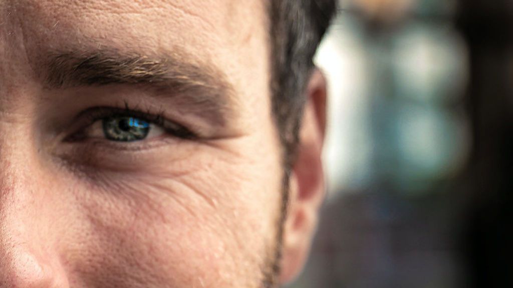 Tratamientos de medicina estética para hombres a partir de 45 años