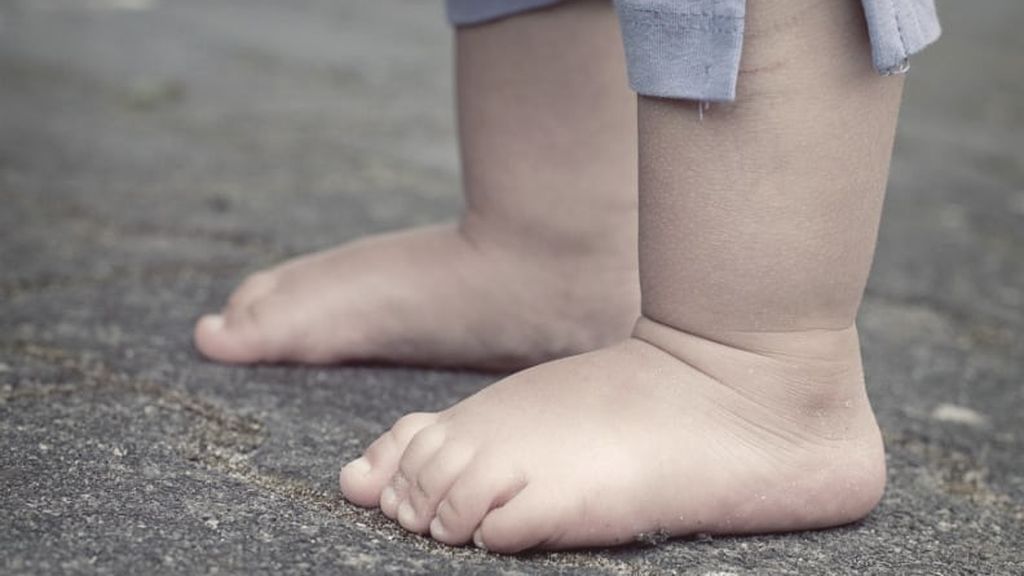 Durante el primer año será normal que tenga esa forma el pie. Luego, irá evolucionando.