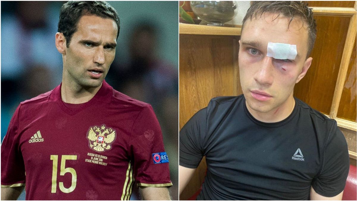 Shirokov y el árbitro tras ser agredido. Shirokov y el árbitro tras ser agredido.