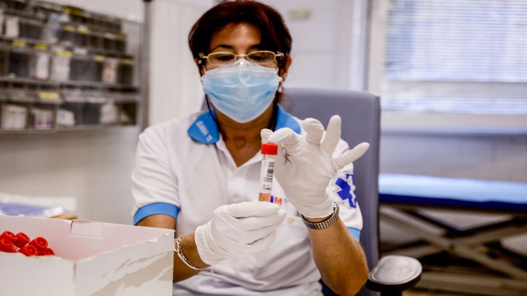 3.000 pruebas PCR para controlar el preocupante aumento de contagios en Reus (Tarragona) 3.000 pruebas PCR para controlar el preocupante aumento de contagios en Reus (Tarragona)