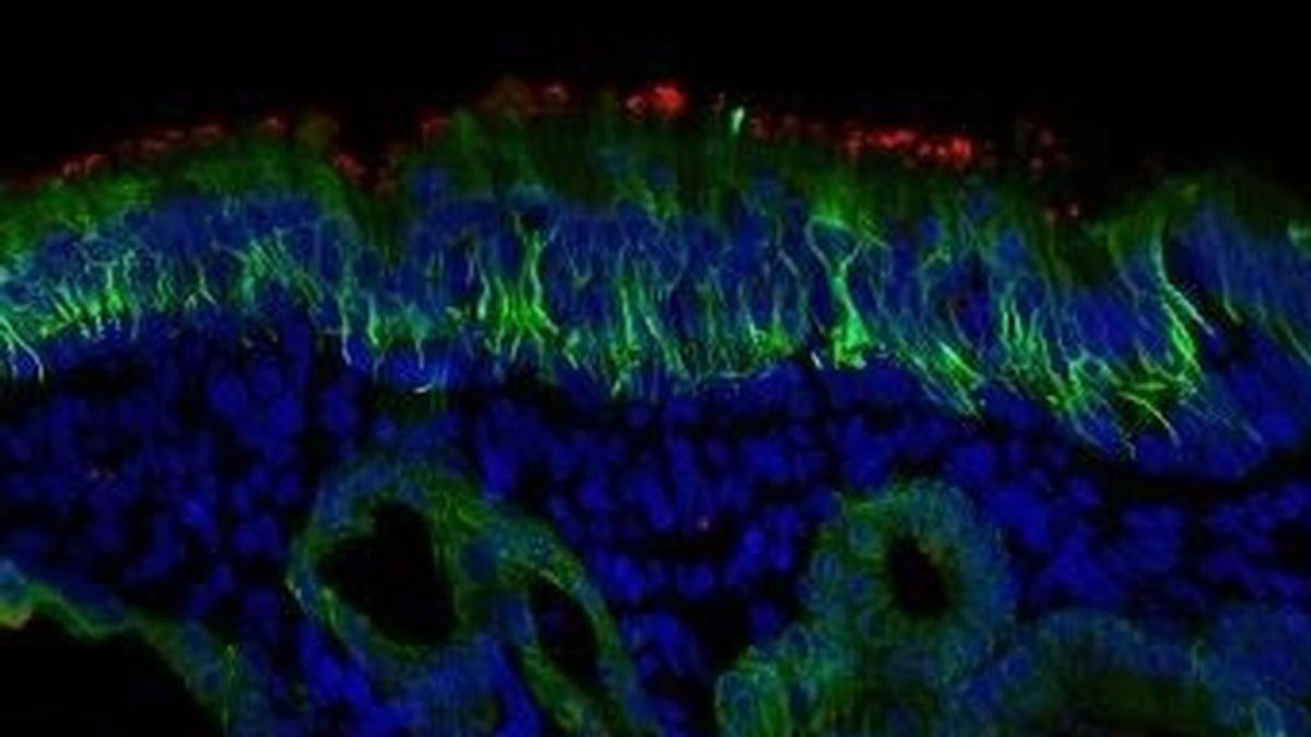 Las células olfativas de la nariz, un buen "gancho" para el coronavirus Las células olfativas de la nariz, un buen "gancho" para el coronavirus