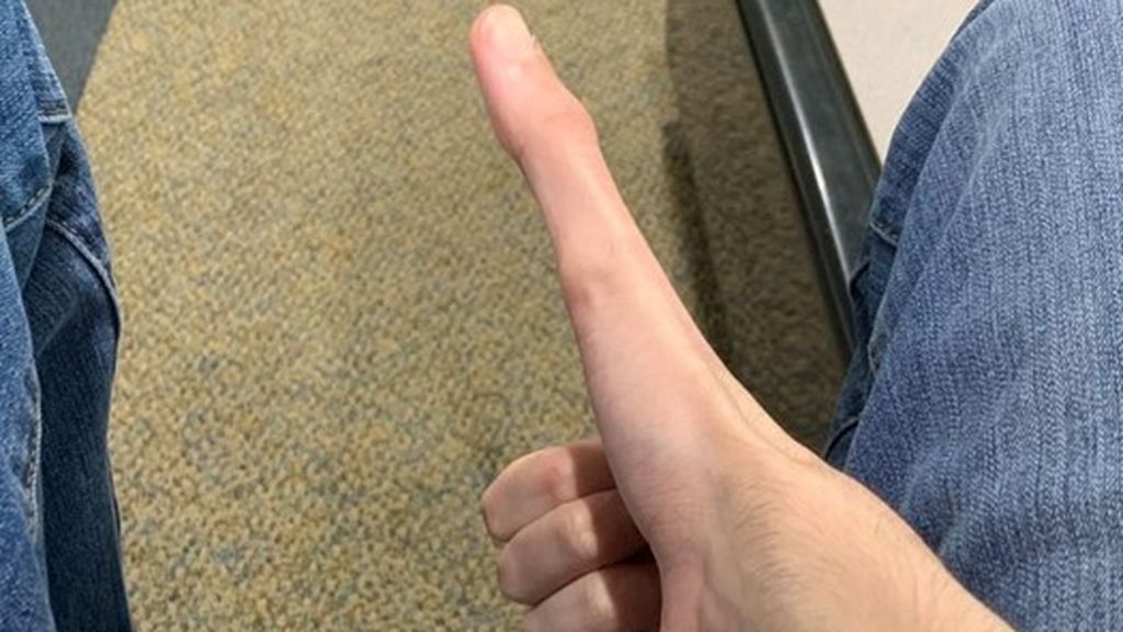 Un joven gana millones de seguidores por tener unos dedos pulgares larguísimos de 12 centímetros