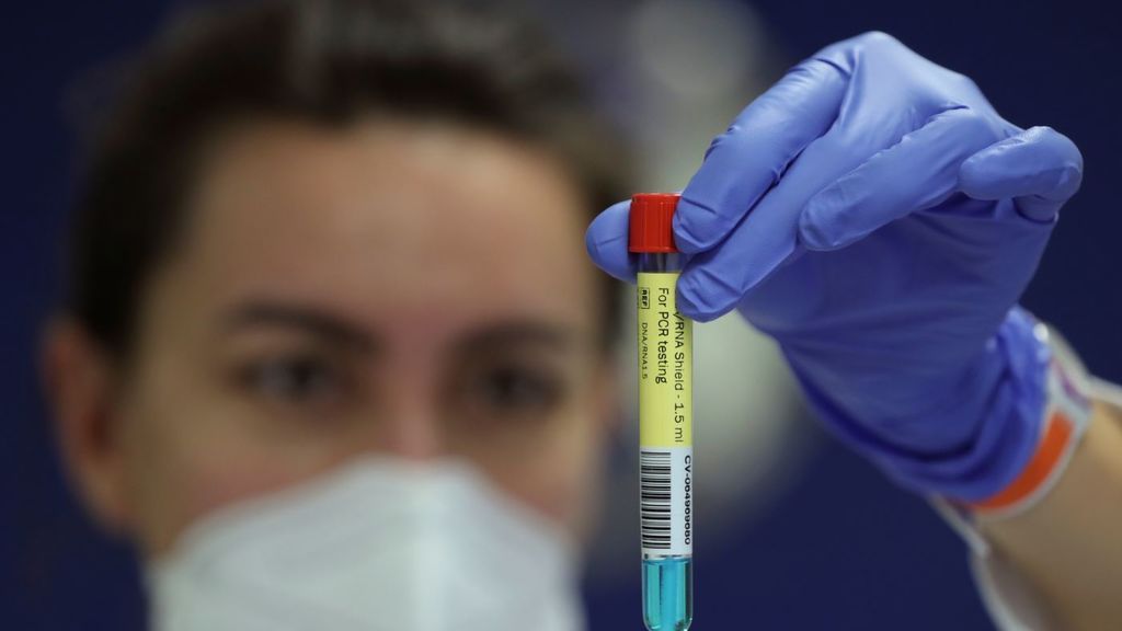 Alemania estudia que los laboratorios veterinarios hagan pruebas de covid-19 tras el aumento de casos Alemania estudia que los laboratorios veterinarios hagan pruebas de covid-19 tras el aumento de casos