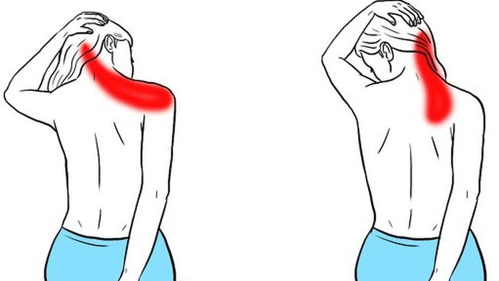 estiramientos de cuello para la zona cervical