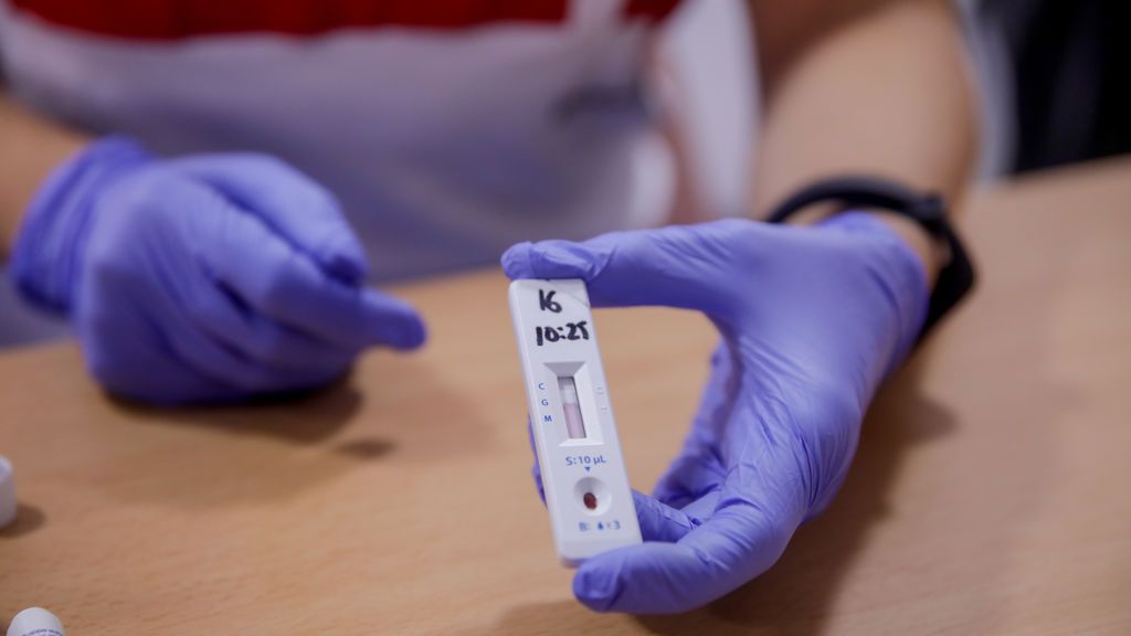 PCR, antígenos y anticuerpos: los tres tipos de test para detectar el coronavirus PCR, antígenos y anticuerpos: los tres tipos de test para detectar el coronavirus
