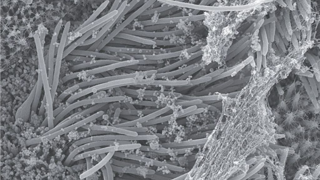 El microscopio muestra al coronavirus en acción en las células pulmonares El microscopio muestra al coronavirus en acción en las células pulmonares