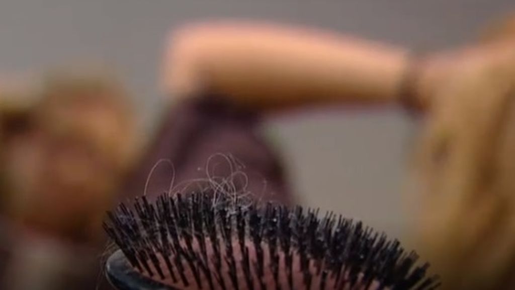 La caída del cabello, otra de las consecuencias del coronavirus