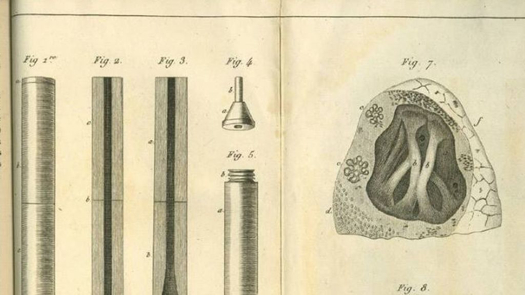 En 1816 el médico francés René Laennec inventó el estetoscopio para diagnosticar a personas con tuberculosis.