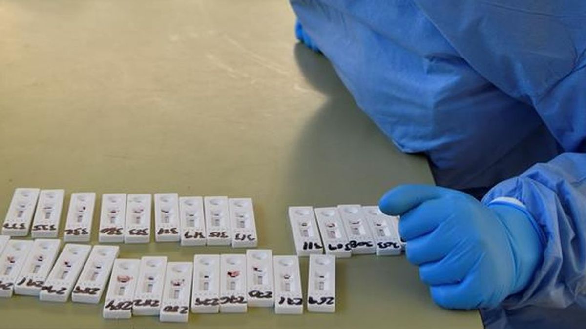 Andalucía comienza a usar un test exprés que detecta  el coronavirus en 15 minutos y con el 100% de fiabilidad