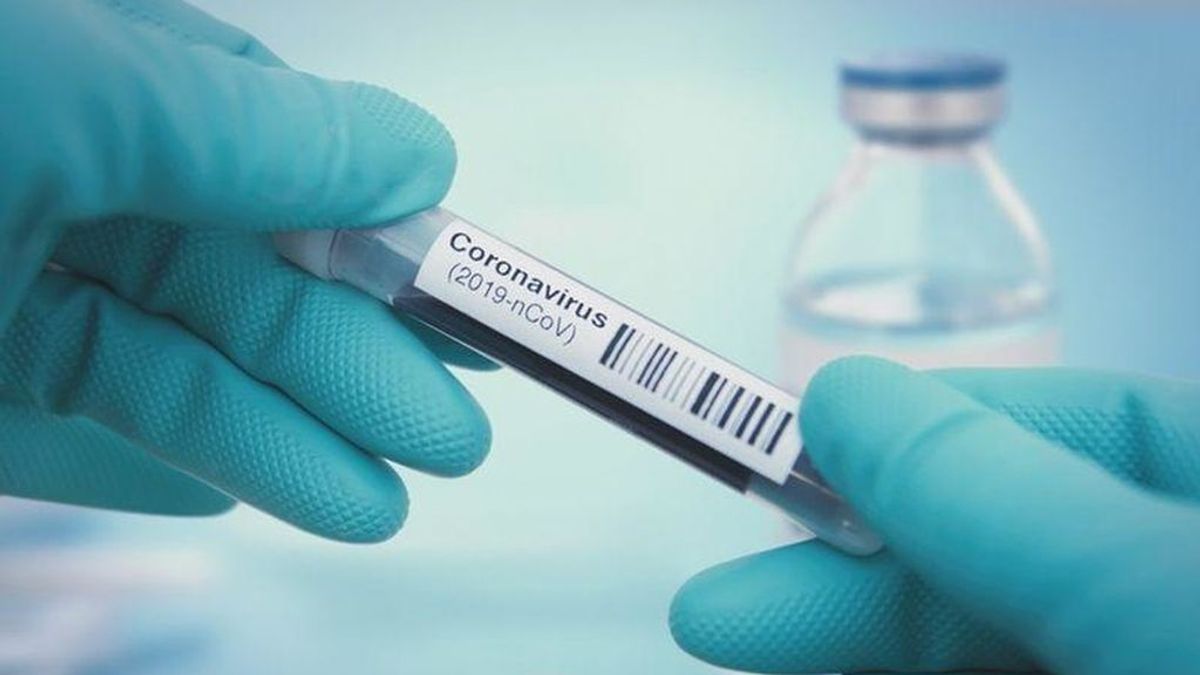 Andalucía comienza a usar un test exprés que detecta el coronavirus en 15 minutos Andalucía comienza a usar un test exprés que detecta el coronavirus en 15 minutos