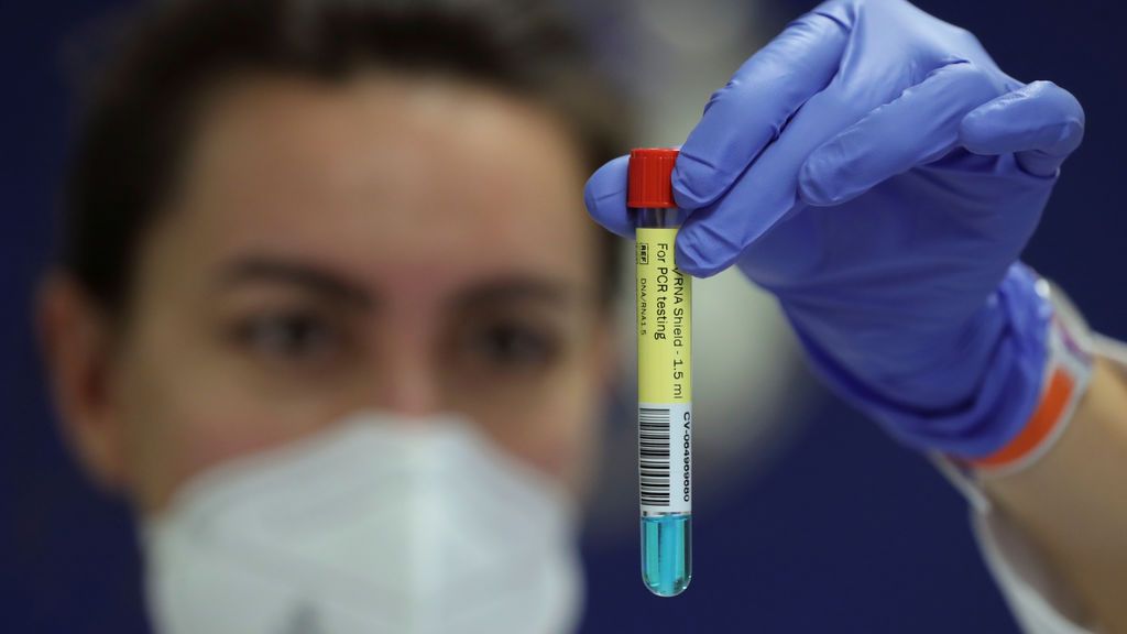 ¿Qué significa que España esté a la cabeza de Europa en 'positividad' del coronavirus? ¿Qué significa que España esté a la cabeza de Europa en 'positividad' del coronavirus?