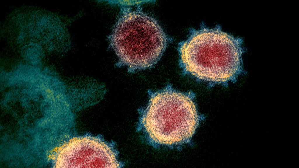 El coronavirus resiste más de 60 grados y el pinchazo de una aguja microscópica El coronavirus resiste más de 60 grados y el pinchazo de una aguja microscópica