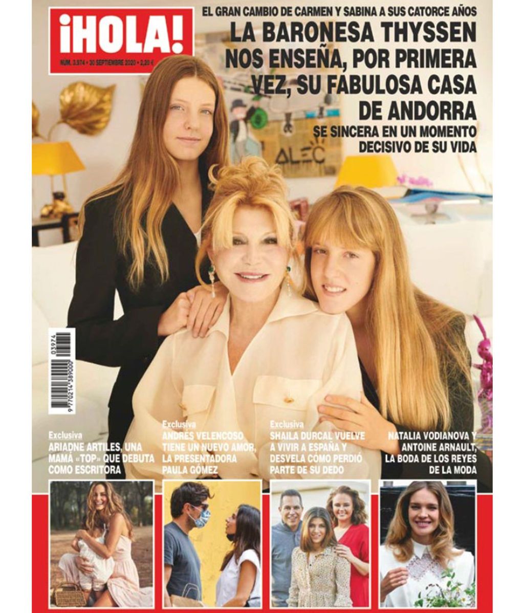 Shaila Durcal regresa a España y cuenta qué es lo que ocurrió con su dedo