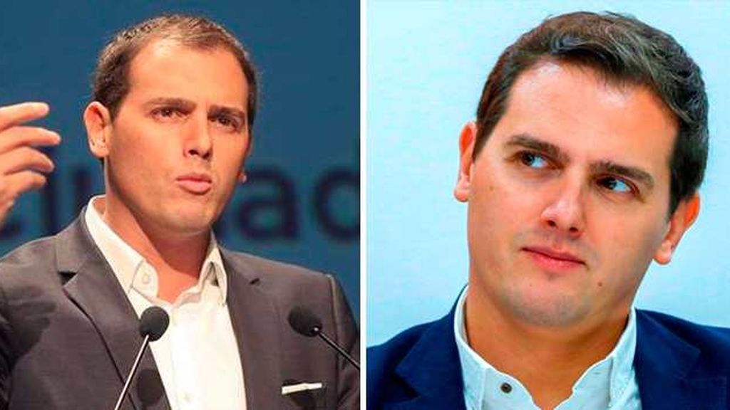 rivera-implante-pelo-1