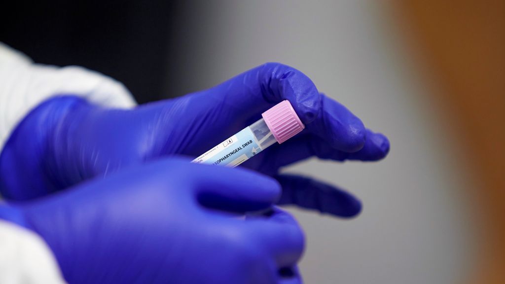 Sanidad registra 12.423 contagios de coronavirus y 126 muertes Sanidad registra 12.423 contagios de coronavirus y 126 muertes