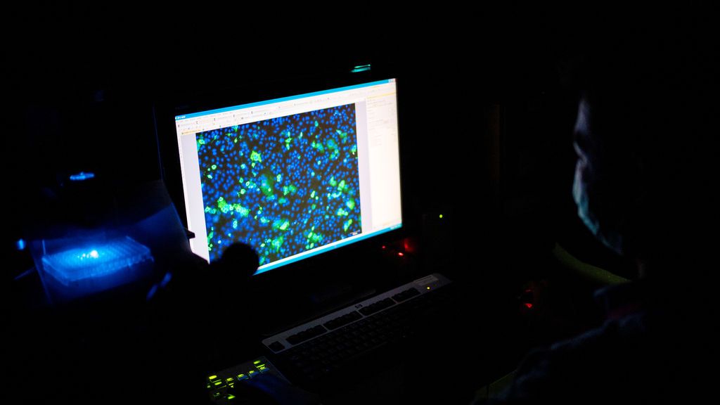 El virus de la COVID-19 puede sobrevivir 28 días a 20 grados, según un estudio El virus de la COVID-19 puede sobrevivir 28 días a 20 grados, según un estudio