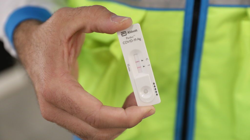 Laboratorios de análisis clínico resaltan que test de antígeno "no pueden ser utilizados para grupos numerosos" Laboratorios de análisis clínico resaltan que test de antígeno "no pueden ser utilizados para grupos numerosos"