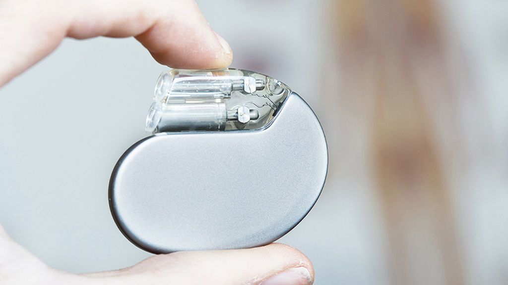 Implantes de desfibriladores automáticos