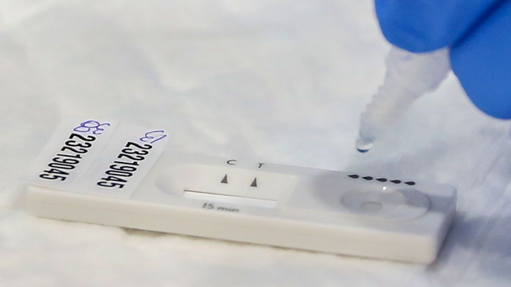 Oxford desarrolla un test que detecta el coronavirus en menos de 5 minutos Oxford desarrolla un test que detecta el coronavirus en menos de 5 minutos