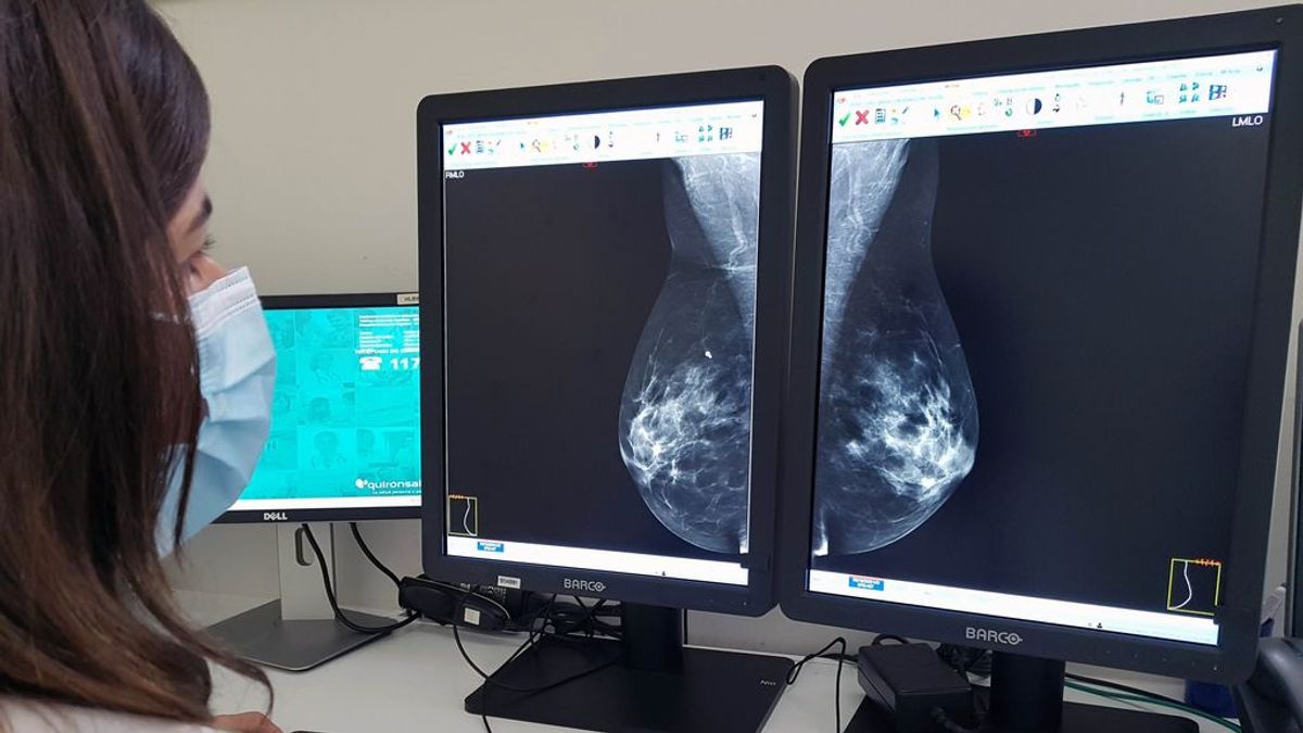 Cáncer de mama: investigación e innovación para curar el 100% de los casos Cáncer de mama: investigación e innovación para curar el 100% de los casos