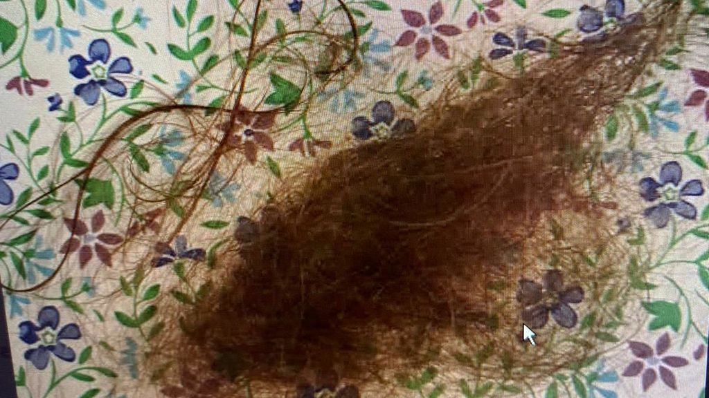 pelo
