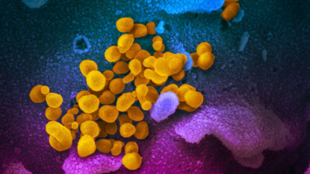 ¿Cómo acaban las epidemias? La historia nos dice que las enfermedades remiten pero es raro que desaparezcan ¿Cómo acaban las epidemias? La historia nos dice que las enfermedades remiten pero es raro que desaparezcan