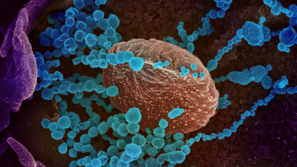 Científicos españoles crean un clon infectivo del SARS-CoV-2 para aprender a combatirlo Científicos españoles crean un clon infectivo del SARS-CoV-2 para aprender a combatirlo