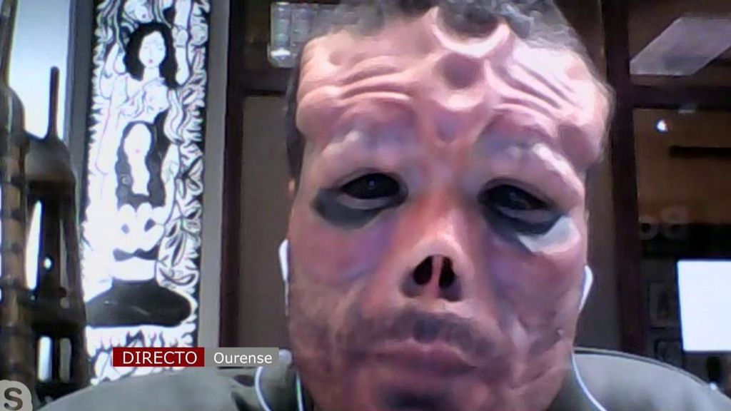 Se opera la cara para parecerse a Red Skull