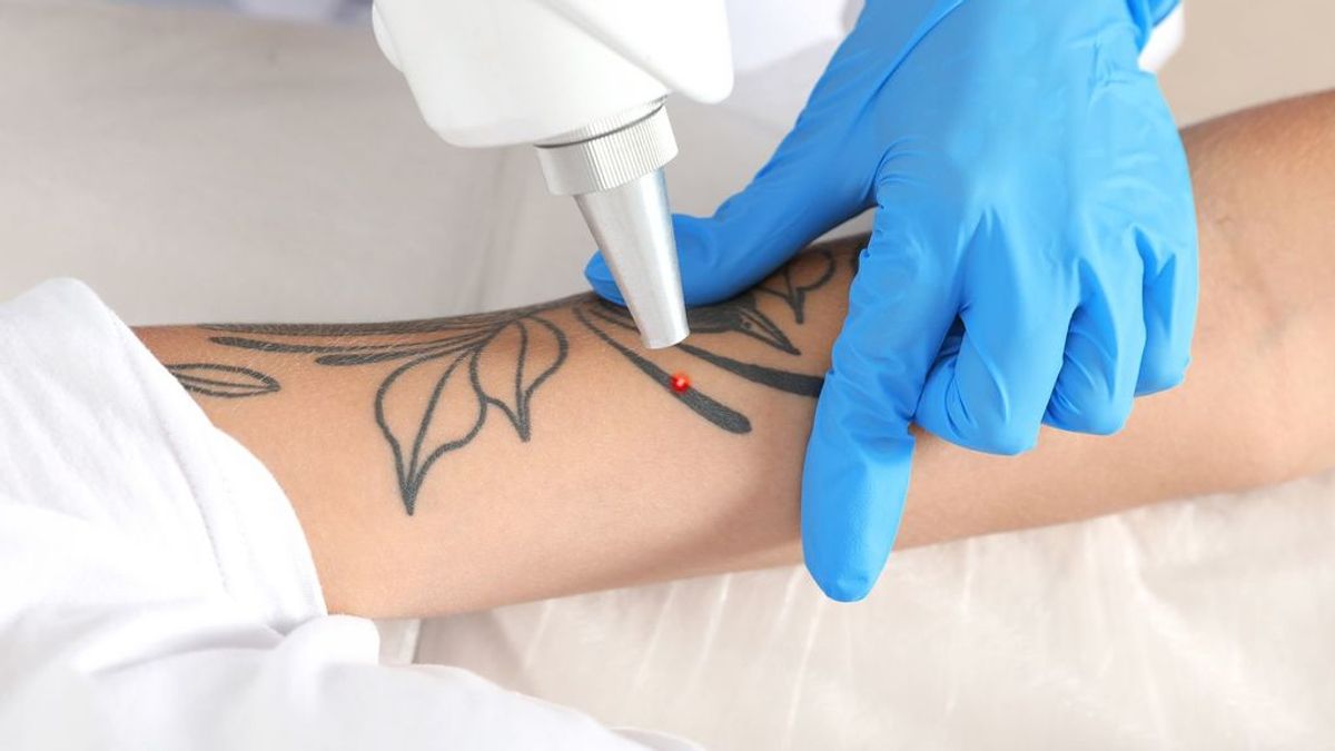 Hay solución si te has arrepentido de tu tatuaje permanente: así podrás quitártelo con láser.