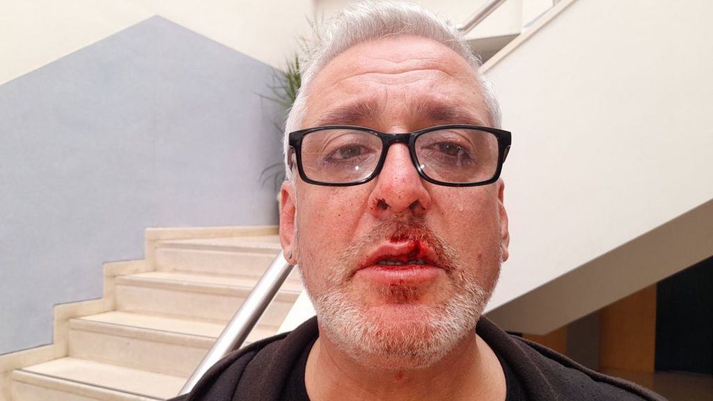 Eduardo Bandera, agredido por bajarse un momento la mascarilla Eduardo Bandera, agredido por bajarse un momento la mascarilla