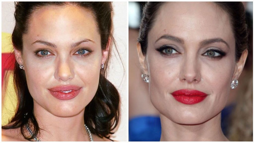 Al igual que Angelina Jolie.