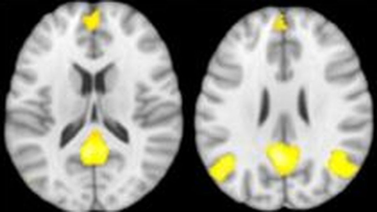 Un estudio de la Universidad de Granda revela cómo funciona el cerebro de los maltratado-res cuando toman decisiones en situaciones de violencia de género Un estudio de la Universidad de Granda revela cómo funciona el cerebro de los maltratado-res cuando toman decisiones en situaciones de violencia de género