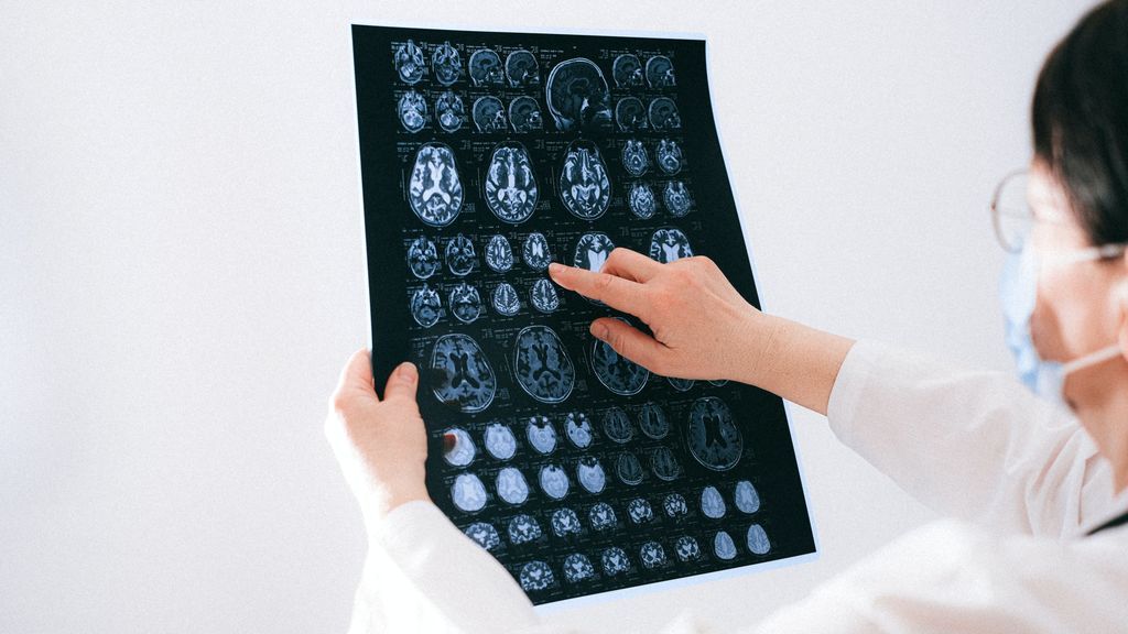 Confusión, delirios o envejecimiento precoz: todo lo que provoca el coronavirus en nuestro cerebro