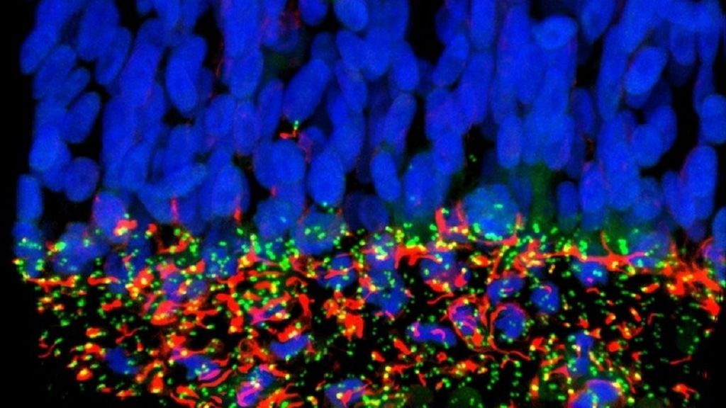 Investigadores españoles identifican la proteína por la que el Zika causa microcefalia en el feto Investigadores españoles identifican la proteína por la que el Zika causa microcefalia en el feto