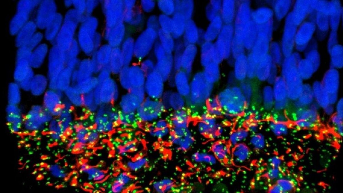 Investigadores españoles identifican la proteína por la que el Zika causa microcefalia en el feto
