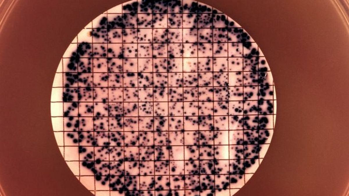 Las infecciones de transmisión sexual aumentan pese a la pandemia de COVID-19, según un estudio Las infecciones de transmisión sexual aumentan pese a la pandemia de COVID-19, según un estudio