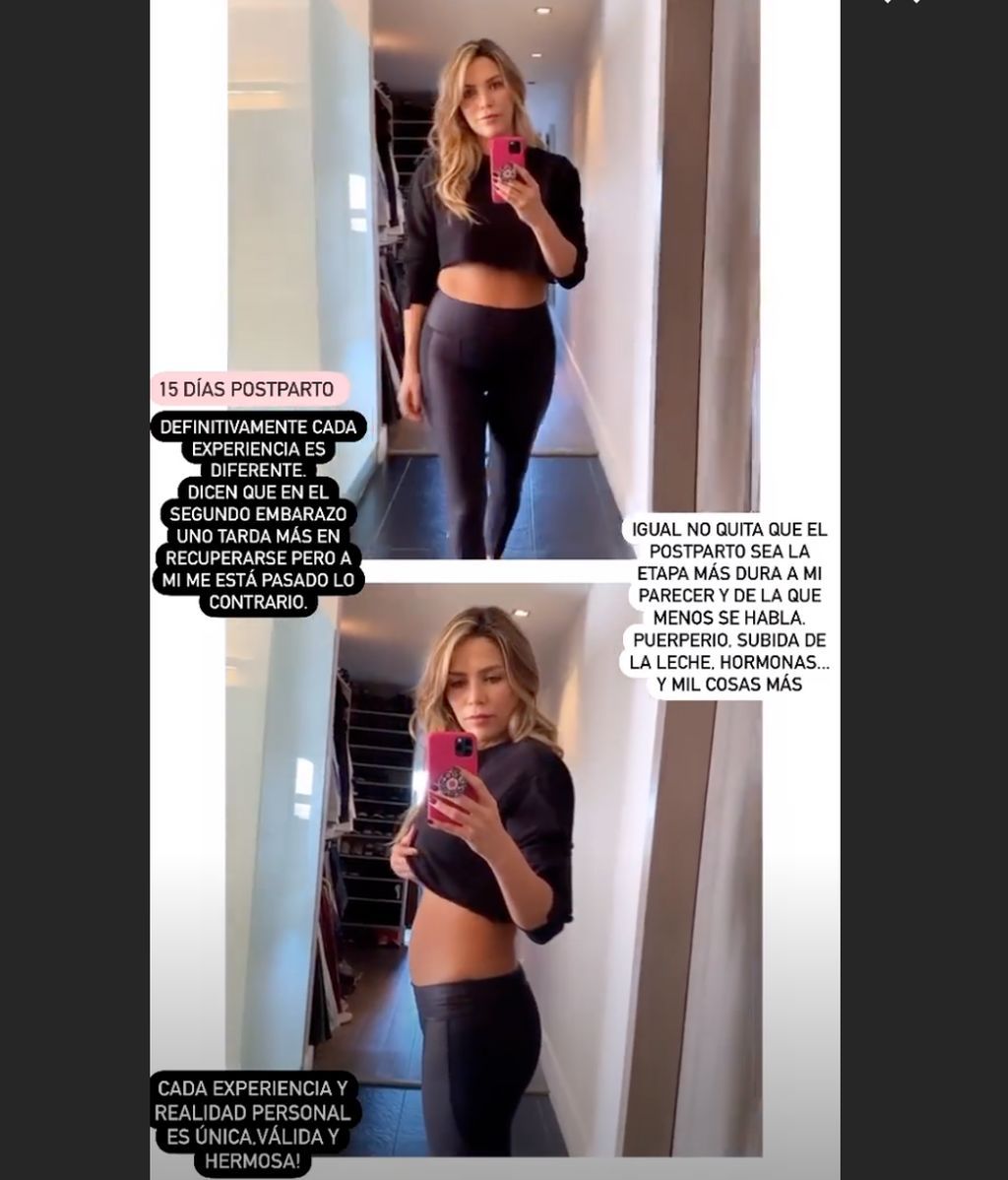 Rosanna Zanetti postparto