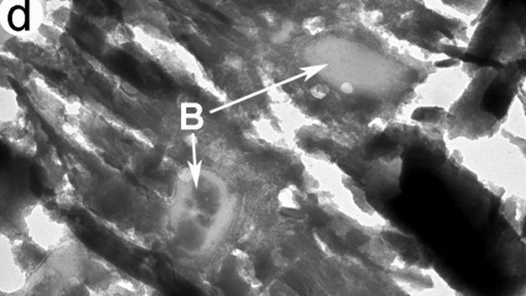 bacteria tres