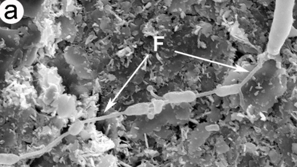 bacteria
